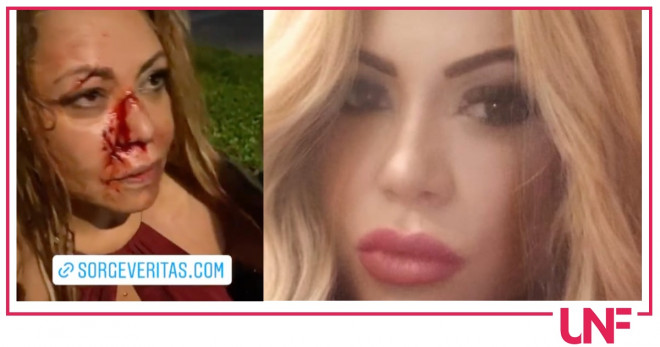 Linda Batista sangue