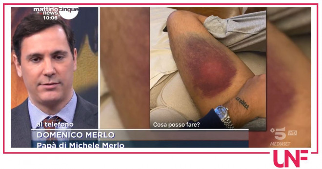 michele merlo