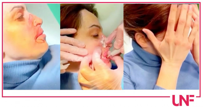 Gessica Notaro operazioni