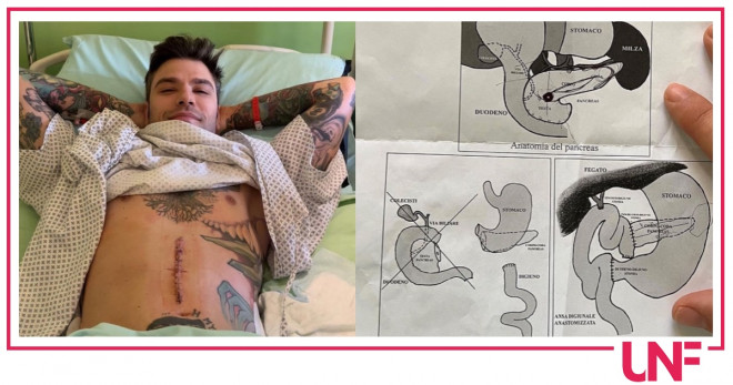 fedez chirurgo