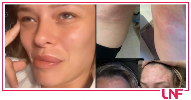 giulia provvedi allergica
