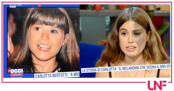 Carlotta bertotti macchia