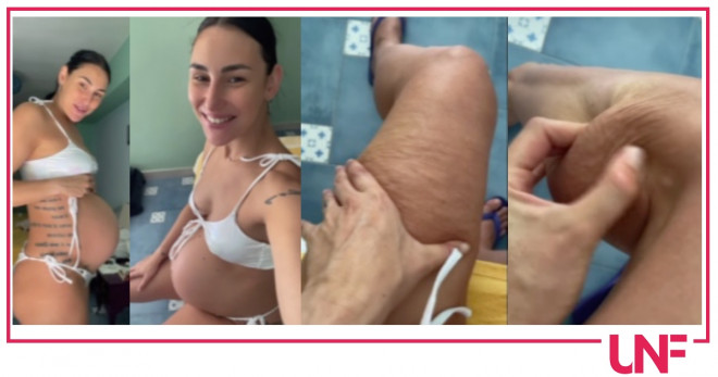 giulia pauselli cellulite