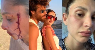 sara bluma denuncia le violenze subite