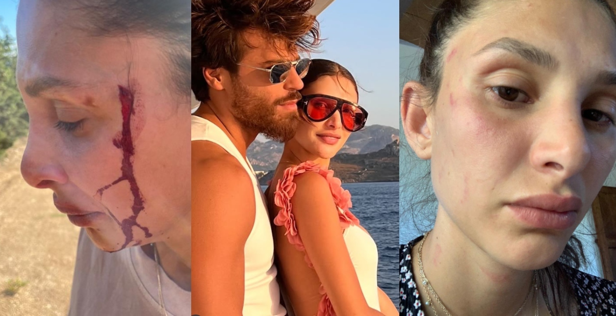 sara bluma denuncia le violenze subite