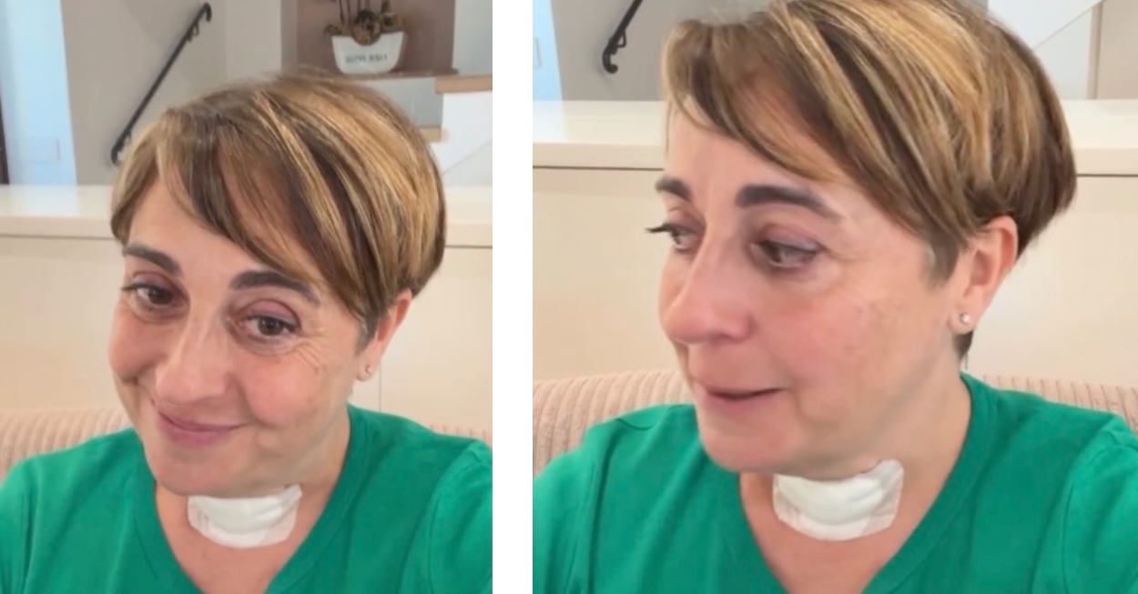 benedetta rossi tiroide