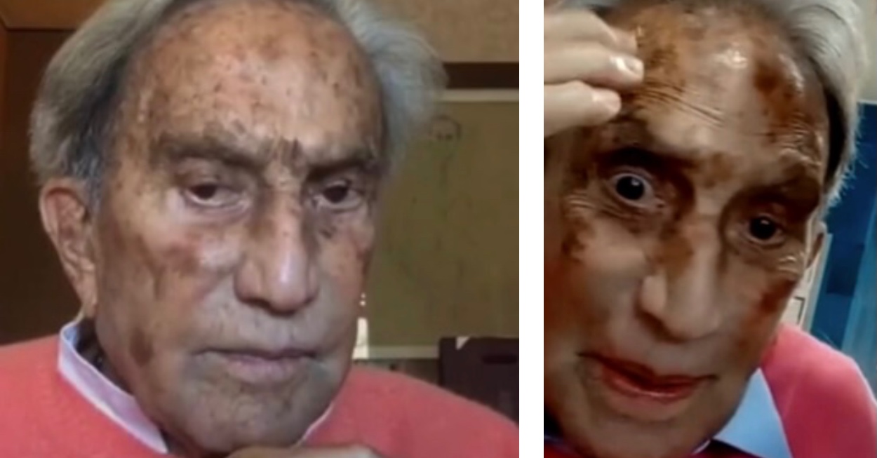 emilio fede malato