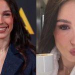 aurora ramazzotti botox