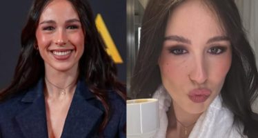 aurora ramazzotti botox