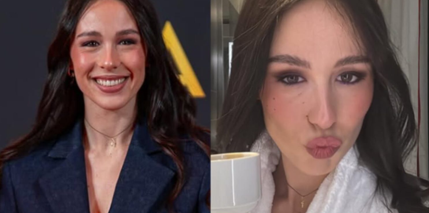 aurora ramazzotti botox