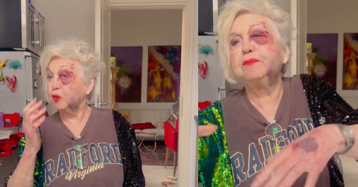 anna marchi investita