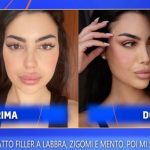 jenny guardiano prima dopo