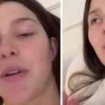 Natalia paragoni linfonodo