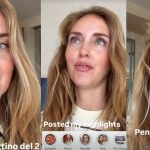 chiara ferragni denti