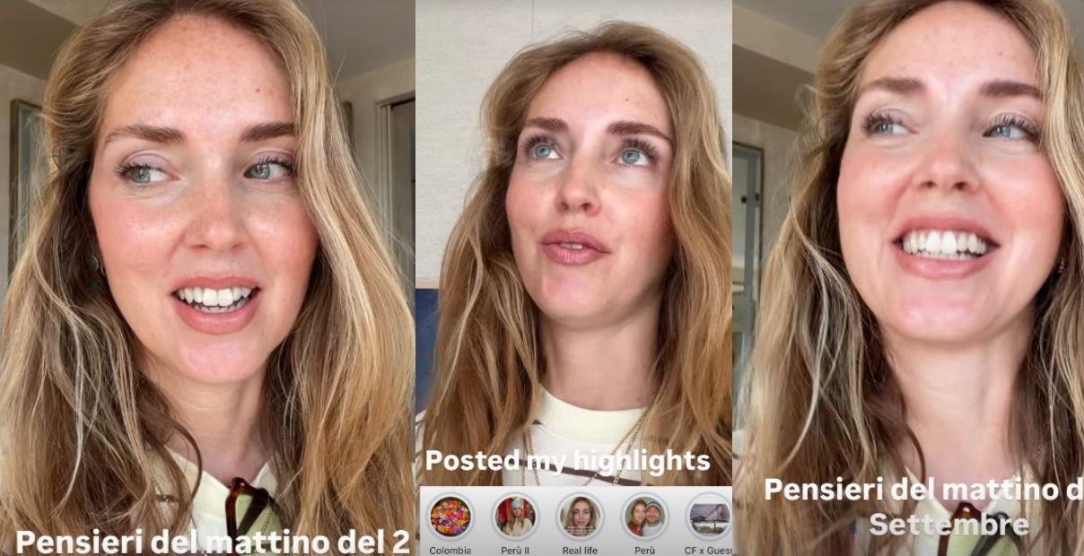 chiara ferragni denti